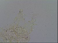 Acanthechiniscus victor image