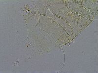 Acanthechiniscus victor image
