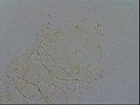 Acanthechiniscus victor image
