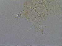 Acanthechiniscus victor image