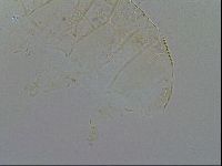 Acanthechiniscus victor image