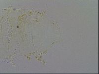 Acanthechiniscus victor image
