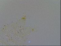 Acanthechiniscus victor image