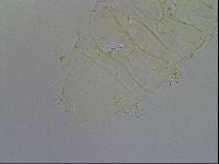 Acanthechiniscus victor image