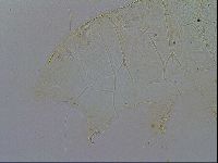 Acanthechiniscus victor image