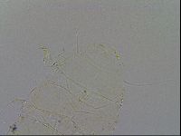 Acanthechiniscus victor image