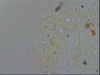 Acanthechiniscus victor image