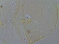 Acanthechiniscus victor image