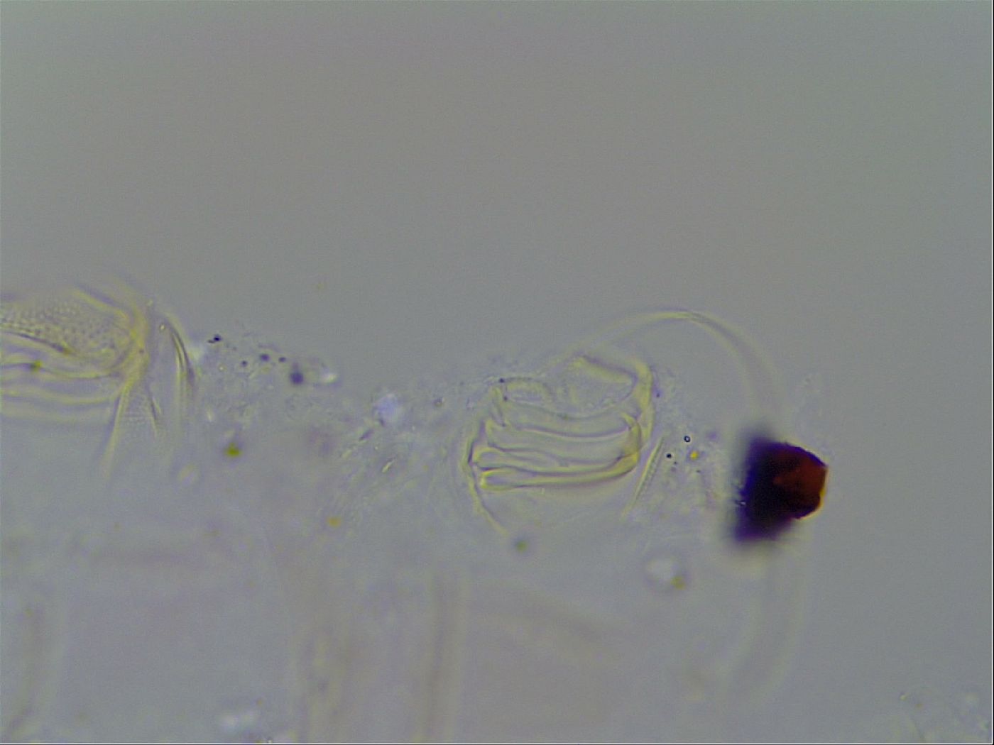 Acanthechiniscus victor image