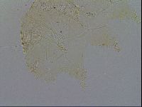 Acanthechiniscus victor image