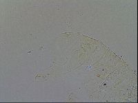 Acanthechiniscus victor image