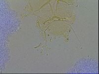 Acanthechiniscus victor image