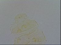 Acanthechiniscus victor image