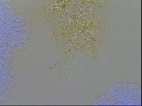 Acanthechiniscus victor image