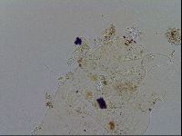 Acanthechiniscus victor image