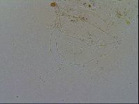 Acanthechiniscus victor image