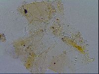 Acanthechiniscus victor image