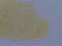 Pseudechiniscus ramazzottii image