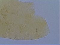 Pseudechiniscus ramazzottii image