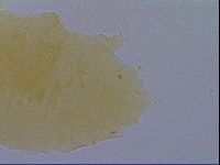 Pseudechiniscus ramazzottii facettalis image