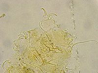 Acanthechiniscus victor image