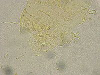 Acanthechiniscus victor image