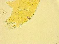 Acanthechiniscus victor image