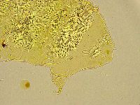 Acanthechiniscus victor image