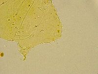 Acanthechiniscus victor image
