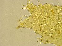 Acanthechiniscus victor image