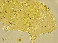 Acanthechiniscus victor image