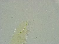 Biserovus bindae image