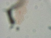 Biserovus bindae image