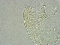 Pseudechiniscus ramazzottii image