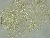 Pseudechiniscus ramazzottii facettalis image