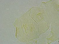 Pseudechiniscus ramazzottii image