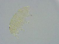 Pseudechiniscus ramazzottii facettalis image