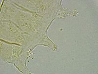 Pseudechiniscus ramazzottii image