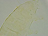 Pseudechiniscus ramazzottii image