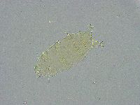 Pseudechiniscus ramazzottii facettalis image