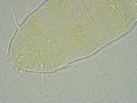 Pseudechiniscus ramazzottii facettalis image