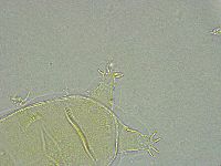 Pseudechiniscus ramazzottii facettalis image