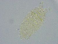Pseudechiniscus ramazzottii facettalis image