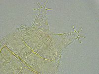 Pseudechiniscus ramazzottii image