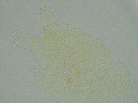 Pseudechiniscus ramazzottii image