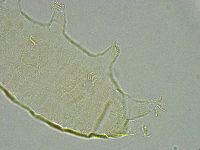 Pseudechiniscus ramazzottii image