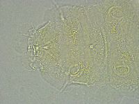 Pseudechiniscus ramazzottii image
