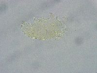 Pseudechiniscus ramazzottii image