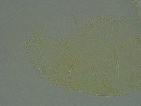 Pseudechiniscus ramazzottii image