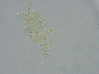 Pseudechiniscus ramazzottii image